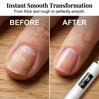 🥳2026 HOT SALE🥳 💅 Limit Time 60% OFF! Professional Electric Nail Polisher – Smooths thick nails, 99-speed display. Multiple heads for shaping & buffing. Salon at home! 🌟💎
