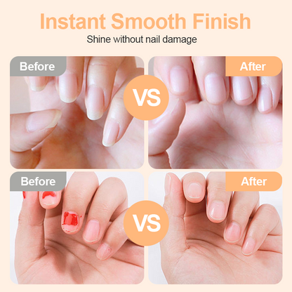 💅 LIMITED‑TIME 50% OFF! ⚡ 2‑in‑1 Safe Electric Nail Clipper – Cut & Polish, Baby‑Safe ✨